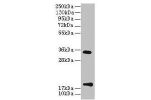Western Blot All lanes: TMEM91 antibody at 16 μg/mL + A549 whole cell lysate Secondary Goat polyclonal to rabbit IgG at 1/10000 dilution Predicted band size: 19, 16, 14, 15 kDa Observed band size: 19, 34 kDa (TMEM91 anticorps  (AA 1-97))