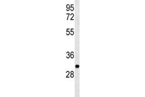 Western blot analysis of PGP antibody and K562 lysate