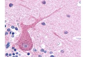 Immunohistochemistry staining of human brain (paraffin sections) using anti-betaIII tubulin (TU-20).