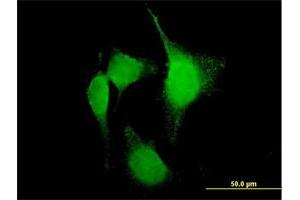 Immunofluorescence of purified MaxPab antibody to PTGS2 on HeLa cell. (PTGS2 anticorps  (AA 1-604))
