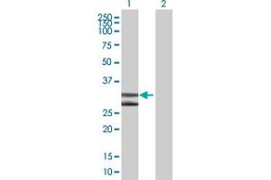 Western Blot analysis of DNALI1 expression in transfected 293T cell line by DNALI1 MaxPab polyclonal antibody. (DNALI1 anticorps  (AA 1-258))