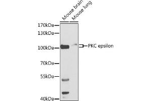 Western blot analysis of extracts of various cell lines, using PKC epsilon antibody (ABIN3022941, ABIN3022942, ABIN3022943 and ABIN6219308) at 1:500 dilution. (PKC epsilon anticorps  (AA 488-737))