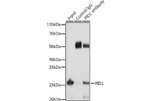 Immunoprecipitation analysis of 25 μg extracts of Mouse liver cells using 3 μg PID1 antibody (ABIN6133302, ABIN6145610, ABIN6145611 and ABIN6217139). (PID1 anticorps  (AA 124-248))