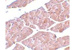 Immunohistochemistry of TRPC3 in mouse heart tissue with TRPC3 polyclonal antibody  at 2 ug/mL . (TRPC3 anticorps  (C-Term))