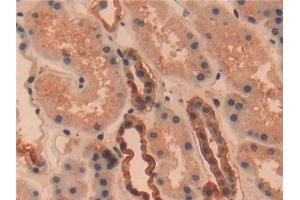 Detection of UCHL1 in Human Kidney Tissue using Polyclonal Antibody to Ubiquitin Carboxyl Terminal Hydrolase L1 (UCHL1)
