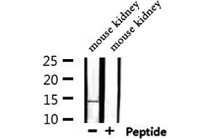 Western blot analysis of extracts from mouse kidney, using MSS4 Antibody. (RABIF anticorps  (N-Term))