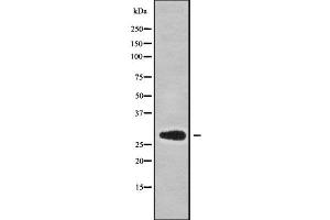 Western blot analysis NKX62 using COS7 whole cell lysates (NKX6-2 anticorps)