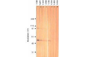 Western Blotting (WB) image for anti-Herpes Simplex Virus, Glycoprotein D (HSV gD) antibody (ABIN265572) (HSV gD anticorps)