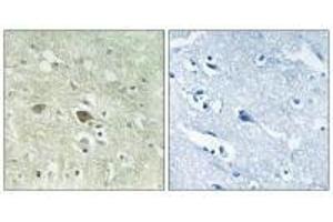 Immunohistochemistry analysis of paraffin-embedded human brain tissue using NDUFV3 antibody. (NDUFV3 anticorps)