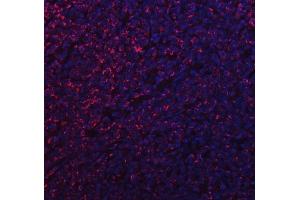 IF analysis of MFF using anti-MFF antibody (ABIN7599292). (MFF anticorps  (AA 1-342))