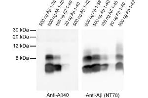 Detection of synthetic Abeta 1-38, 1-40 and 1-42 with anti-Abeta 40 (dilution 1 : 1000) and anti-Abeta (Cat. (Abeta 1-40 anticorps  (AA 33-40))