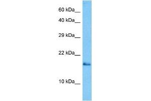Host:  Mouse  Target Name:  GABARAP  Sample Tissue:  Mouse Skeletal Muscle  Antibody Dilution:  1ug/ml