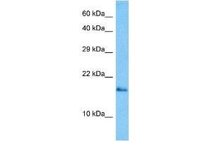 Host:  Mouse  Target Name:  GABARAP  Sample Tissue:  Mouse Skeletal Muscle  Antibody Dilution:  1ug/ml (GABARAP anticorps  (N-Term))
