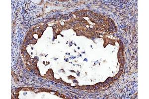 IHC analysis of RRS1 using anti-RRS1 antibody (ABIN7602918).