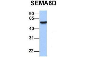 Host:  Rabbit  Target Name:  SEMA6D  Sample Type:  Human Adult Placenta  Antibody Dilution:  1. (SEMA6D anticorps  (N-Term))