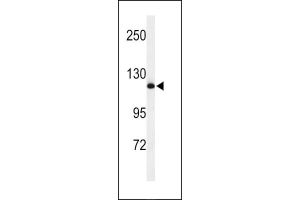 NEDD4 anticorps  (C-Term)