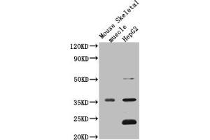 Western Blot Positive WB detected in: Mouse heart tissue, Mouse liver tissue, Mouse kidney tissue, Mouse brain tissue, Mouse skeletal muscle tissue, Mouse stomach tissue All lanes: MTND1 antibody at 3 μg/mL Secondary Goat polyclonal to rabbit IgG at 1/50000 dilution Predicted band size: 36 kDa Observed band size: 36 kDa (MT-ND1 anticorps  (AA 23-67))