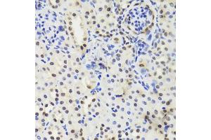 Immunohistochemistry of paraffin-embedded mouse kidney using EFTUD2 Antibody (ABIN5974236) at dilution of 1/100 (40x lens). (EFTUD2 anticorps)