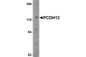 Western Blotting (WB) image for anti-Protocadherin 12 (PCDH12) (N-Term) antibody (ABIN1031505) (PCDH12 anticorps  (N-Term))