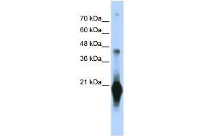 WB Suggested Anti-C17orf49 Antibody Titration: 0. (C17orf49 anticorps  (Middle Region))