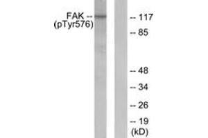 Western blot analysis of extracts from NIH-3T3 cells, using FAK (Phospho-Tyr576) Antibody. (FAK anticorps  (pTyr576))