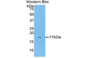 Western blot analysis of the recombinant protein. (Adrenomedullin anticorps  (AA 35-171))
