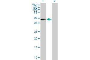 Western Blot analysis of ZNF193 expression in transfected 293T cell line by ZNF193 MaxPab polyclonal antibody. (Zinc Finger and SCAN Domain Containing 9 (ZSCAN9) (AA 1-394) anticorps)