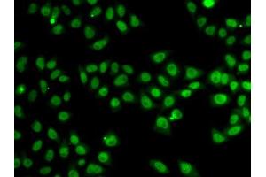 Immunofluorescence analysis of MCF-7 cells using SND1 antibody. (SND1 anticorps  (AA 26-285))
