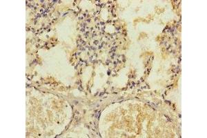 Immunohistochemistry of paraffin-embedded human lung tissue using ABIN7147376 at dilution of 1:100 (PLK1S1 anticorps  (AA 1-240))
