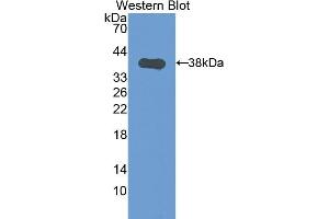 Detection of Recombinant CK1, Mouse using Polyclonal Antibody to Cytokeratin 1 (CK1) (Cytokeratin 1 anticorps  (AA 189-497))