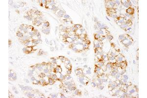 Immunohistochemistry (IHC) image for anti-Prohibitin (PHB) (AA 222-272) antibody (ABIN7453838) (Prohibitin anticorps  (AA 222-272))