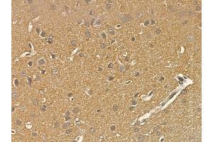 SCLT1 Mouse Monoclonal Antibody at 1/100 staining rat brain tissue by IHC-P. (Sclt1 anticorps)