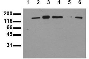 Western Blotting (WB) image for anti-Receptor Tyrosine-Protein Kinase ErbB-3 (ERBB3) (C-Term) antibody (ABIN126793) (ERBB3 anticorps  (C-Term))