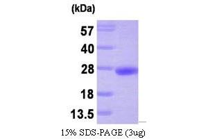 SDS-PAGE (SDS) image for Protein Tyrosine Phosphatase Type IVA, Member 3 (PTP4A3) (AA 1-173) protein (His tag) (ABIN666667)