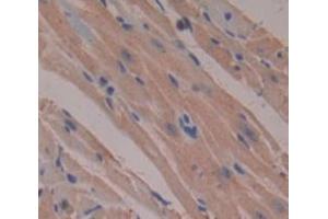 IHC-P analysis of Human Tissue, with DAB staining. (SNX9 anticorps  (AA 250-595))