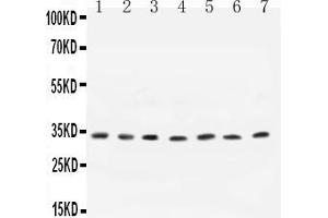 Anti- Cyclin D1 antibody, All Western blottingAll lanes: Anti-CCND1 at 0. (Cyclin D1 anticorps  (N-Term))