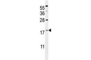 S100A4 antibody western blot analysis in mouse NIH3T3 lysate. (s100a4 anticorps  (AA 1-30))