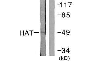 Western blot analysis of extracts from LOVO cells, using HAT antibody. (HAT anticorps  (Internal Region))