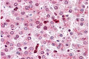 Human Liver: Formalin-Fixed, Paraffin-Embedded (FFPE)