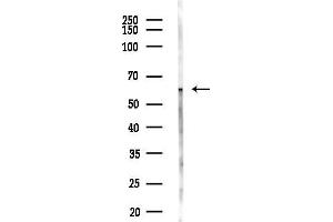 anti-Keratin 77 (KRT77) (Internal Region) antibody