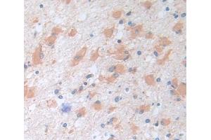 Used in DAB staining on fromalin fixed paraffin- embedded brain tissue (TRIM3 anticorps  (AA 2-152))