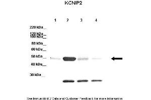 Lanes:   Lane 1: 20ug HEK-293 cell lysate Lane 2: 20ug mkchIP2-YFP transfected HEK-293 lysate Lane 3: 20ug mkchIP3-YFP transfected HEK-293 lysate Lane 4: 20ug mkchIP4-YFP transfected HEK-293 lysate  Primary Antibody Dilution:   1:1000  Secondary Antibody:   Donkey anti-rabbit-HRP  Secondary Antibody Dilution:   1:10,000  Gene Name:   KCNIP2  Submitted by:   Jeanne M.