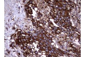 Image no. 2 for anti-Tumor Necrosis Factor Receptor Superfamily, Member 8 (TNFRSF8) (AA 19-379) antibody (ABIN1491084)