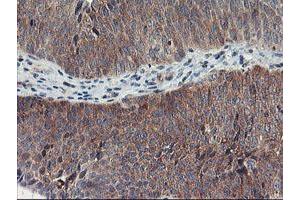 Image no. 3 for anti-Tubby Like Protein 3 (TULP3) antibody (ABIN1501583)