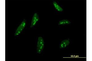 Immunofluorescence of monoclonal antibody to BMP2K on HeLa cell.