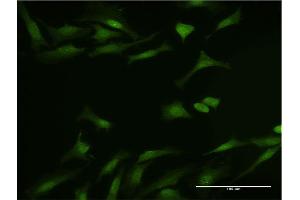 Immunofluorescence of monoclonal antibody to DYNLL1 on HeLa cell.