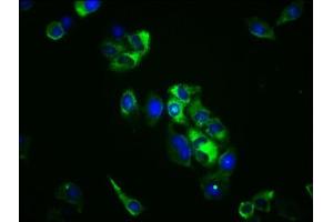 Immunofluorescence staining of Hela cells with ABIN7171265 at 1:100, counter-stained with DAPI. (STXBP5 anticorps  (AA 515-610))