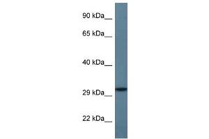 WB Suggested Anti-STX11 Antibody Titration: 1. (Syntaxin 11 anticorps  (C-Term))