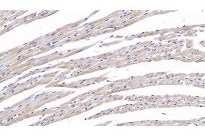 Detection of TNC in Rat Cardiac Muscle Tissue using Polyclonal Antibody to Tenascin C (TNC) (TNC anticorps  (AA 513-621))