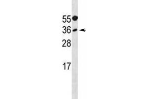 MYF5 antibody western blot analysis in A549 lysate.